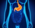 Click to see image detail Gastroparesis.jpg