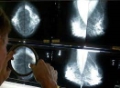 Click to see image detail FamHistBreastCancer.jpg