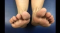 Click to see image detail leglengths.jpg